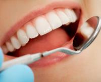 wisdom teeth removal cost image 1